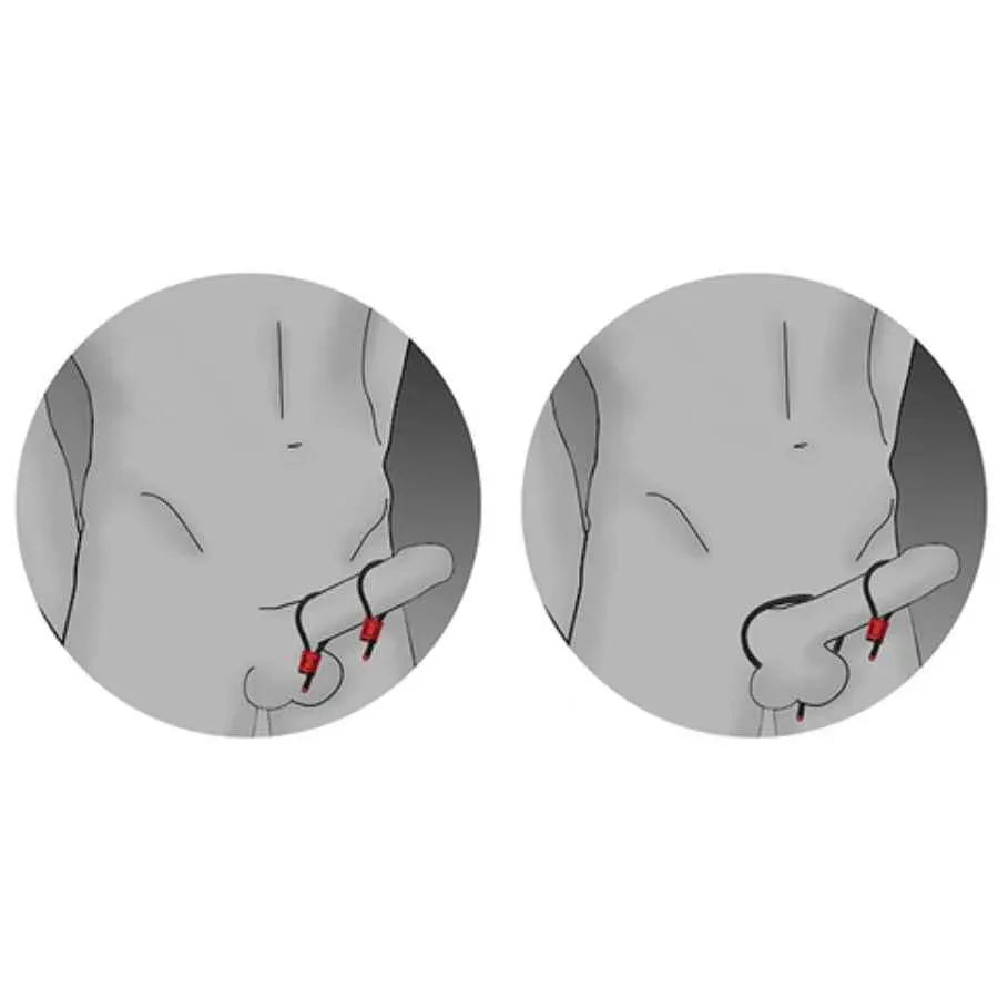 ELECTRASTIM - PRESTIGE ELECTRA LOOPS VERSTELLBARE COCKRINGE ROT - Vanelion Paradise